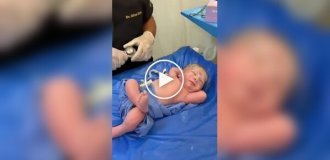 Новорожденный удивил своим спокойствием