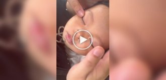 Китайские мамы стали клеить детям с младенчества наклейки для двойного века, чтобы они выросли «красивее»
