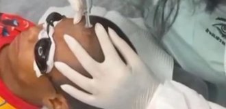Hooligans gave a boy an offensive tattoo on his forehead (5 photos + (1 video)