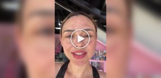 Девушка получила сильные ожоги лица на дне рождения