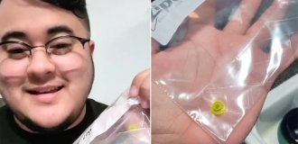 A guy lived with a Lego piece in his nose for over 25 years (3 photos + 1 video)