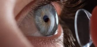 Контактні лінзи для міопії та гіперметропії, сучасний підхід до корекції зору.