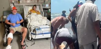 A victim of a shark attack spoke about the horror he experienced (5 photos)