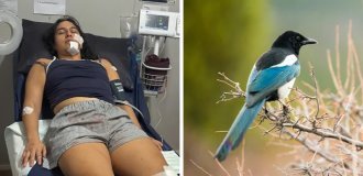 Женщине требуется операция после нападения сороки (4 фото)