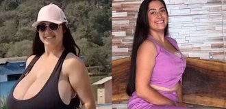 Грудь студентки ежемесячно увеличивалась на 750 граммов (4 фото + 1 видео)