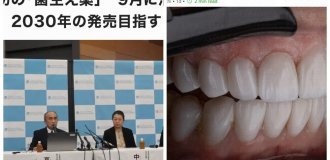 Перші у світі «ліки для зростання зубів» будуть випробувані в Японії з вересня 2024 року (3 фото)