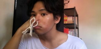 Why do Filipinos put clothespins on their children's noses (6 photos)