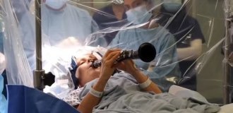 Пациентка играла на кларнете во время четырёхчасовой операции на головном мозге (3 фото + 1 видео)
