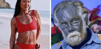 Люди, особенности тела которых делают их уникальными и непохожими на остальных (20 фото)