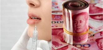 Миллион на силикон: как китаянка превратила парня своей подруги в спонсора "идеальных губ" (4 фото)