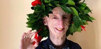 The most famous person with progeria Sammy Basso has died (2 photos)