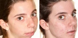A Whole New Person: 22 Stunning Before-and-After Plastic Surgery Transformations (22 photos)