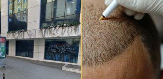 Британец умер во время пересадки волос в Турции (3 фото)