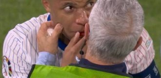 Mbappe broke his nose at Euro 2024 (3 photos)