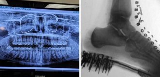 15 cases when X-rays showed that interesting things can be seen inside ordinary things (16 photos)