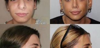 Miracles of plastic surgeons from Turkey (9 photos)