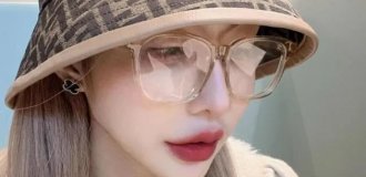 Model after 19 plastic surgery is surprised by what the x-ray of her body at the airport showed (4 photos)