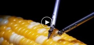 Невероятные навыки нейрохирургов