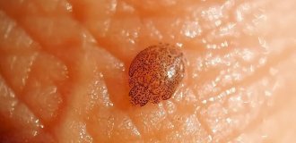 Sea lice: who bites on the beach and in the water? (7 photos)