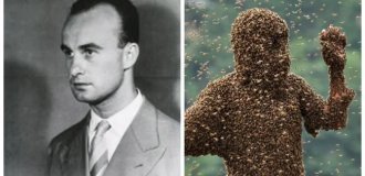 Urbach-Wiethe disease is an illness that turns the body into fearless hostage of his own molecules (10 photos)