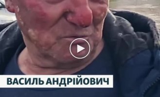 Киевлянин после ракетной атаки отогнал свою горящую машину со стоянки, чтобы не загорелись другие