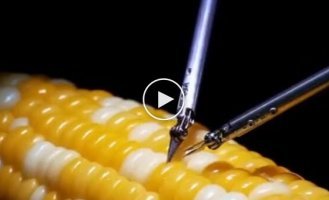 Неймовірні навички нейрохірургів