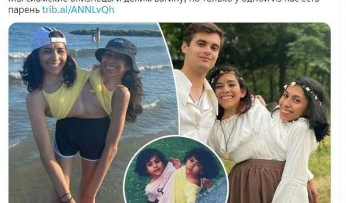 In Mexico, the guy started dating a girl, despite her Siamese twin (8 photos)