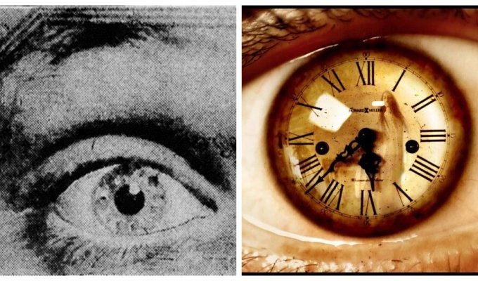 Clock-Eyed Boy Harold Maconaghy (5 photos)
