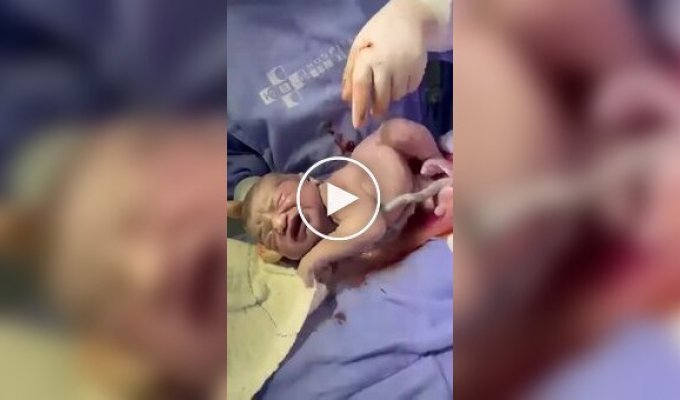 The beginning of the life of a child born in the amniotic sac