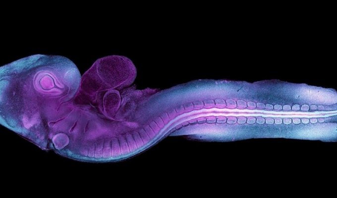 Ученые впервые запечатлели процесс формирования эмбриона на ранней стадии развития (6 фото + 1 видео)