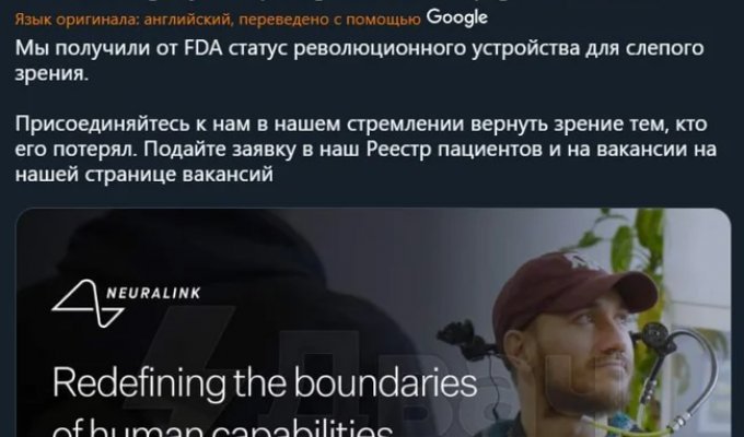 Компанія Neuralink винайшла Blindsight - імплант, який відновлює зір (2 фото)