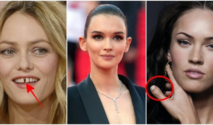 Celebrities who are not ashamed of their body and openly show defects (14 photos)