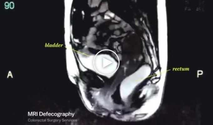 Взгляд на человеческое тело при помощи МРТ (18+)