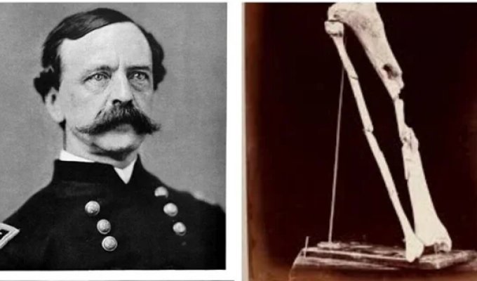 Daniel Sickles' limb and its adventures (9 photos + 1 video)