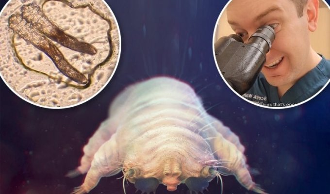 A tick that breeds on your face at night (9 photos + 1 video)