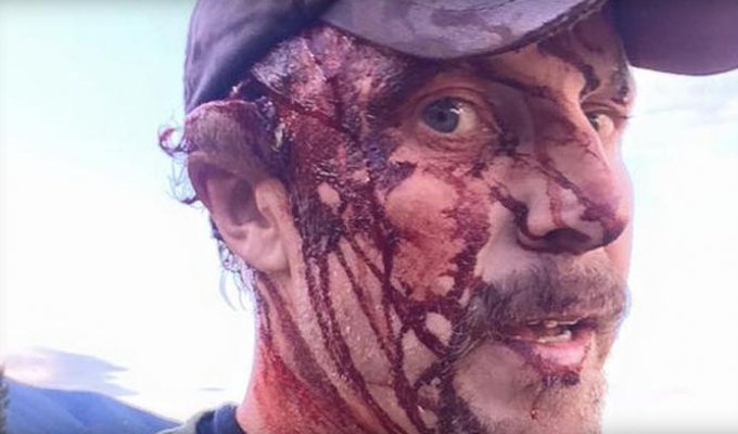 Американский охотник рассказал о том, как подвергся двойному нападению гризли (4 фото + видео)