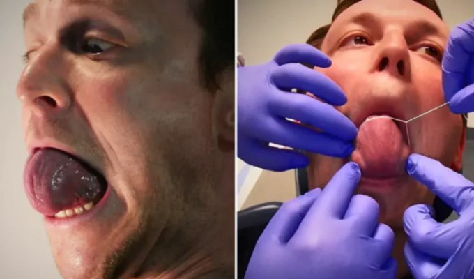 “Tired of indecent jokes”: how the man with the world’s largest tongue lives (3 photos + 1 video)