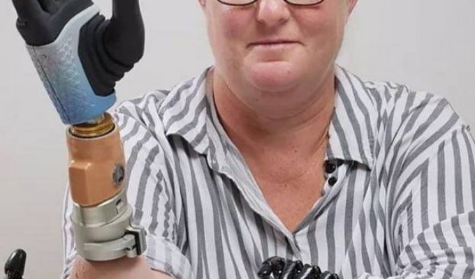 С помощью бионического протеза женщина впервые почувствовала силу нажима и текстуру поверхности (3 фото)