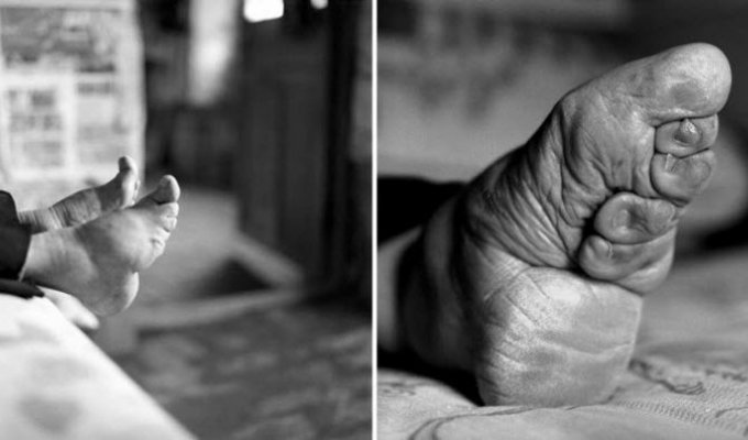 19 фотографий китайских женщин, переживших мучительную процедуру бинтования ног (20 фото)