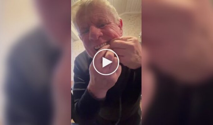 Британец вырвал себе зуб с помощью гантели и шнурка