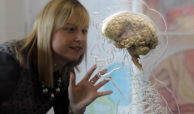 В Бристольском научном центре выставили человеческий мозг (7 фото)