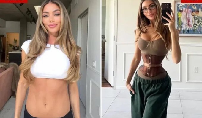Девушки по всему миру начали массово удалять себе рёбра ради талии мечты (3 фото)
