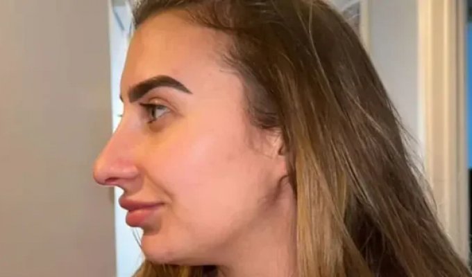 A woman paid $14 thousand for a nose job: it seems the plastic surgeon "heard her wrong" (4 photos + 1 video)