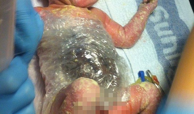 Новорожденную пришлось обмотать упаковочной пленкой, чтобы не повредить выпавшие внутренние органы (5 фото)