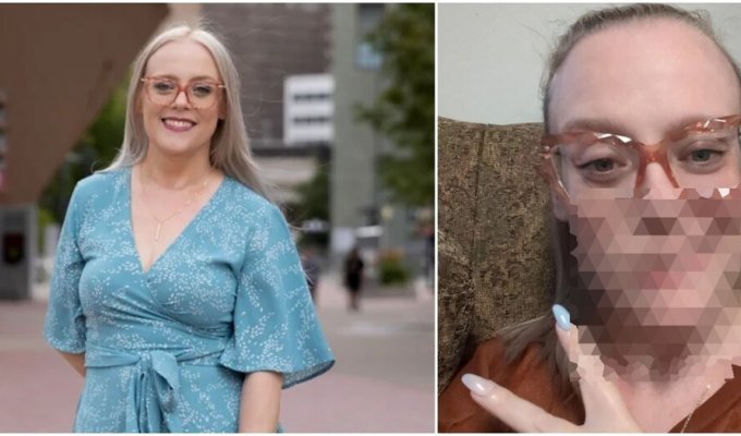 The girl was distorted after a Botox injection (4 photos)