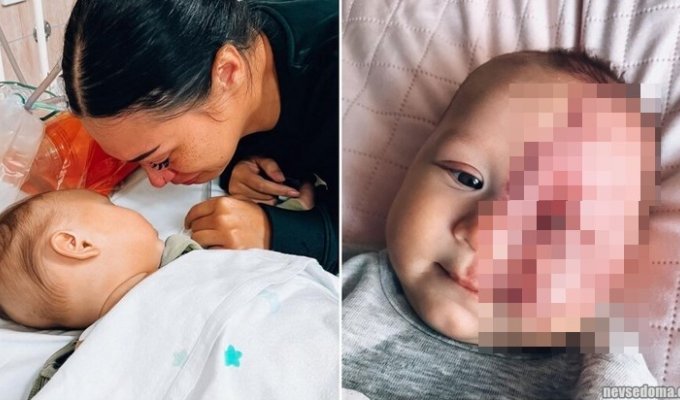 A woman gave birth to a special child, but she was condemned on social networks for wanting to help her newborn son (8 photos)