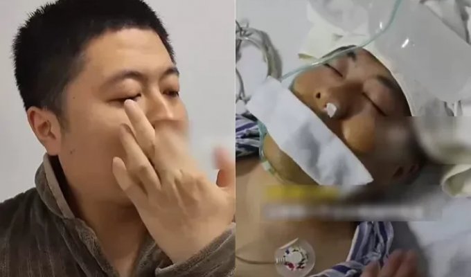 He loved to pick his nose and paid the price: the man underwent emergency surgery (2 photos)