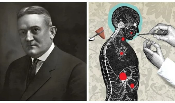 Дантист из преисподней: как доктор Коттон лечил душевные недуги, удаляя пациентам органы (6 фото)