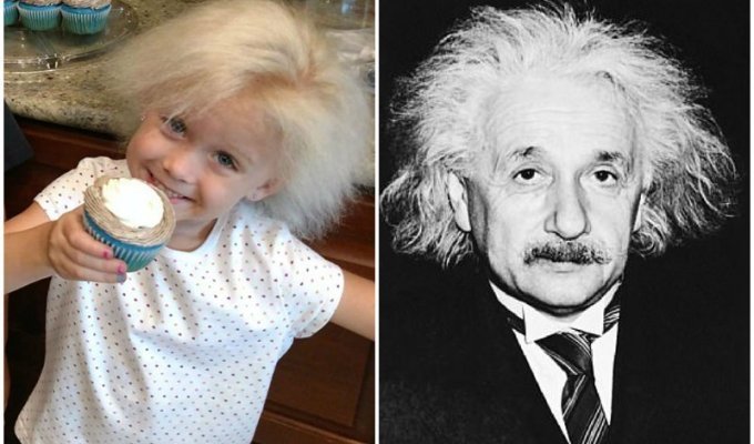 Из-за редкой мутации у 5-летней девочки растут волосы Эйнштейна (5 фото)