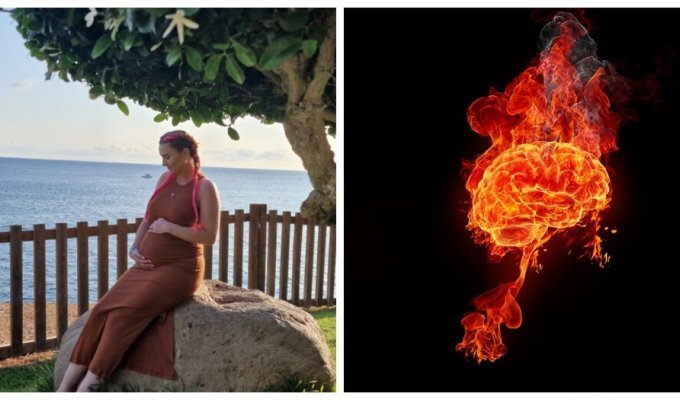A woman with a rare “brain on fire” disease refuses to recognize her newborn daughter as her own (6 photos)